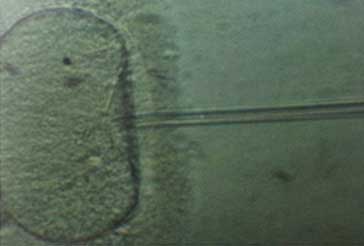 ICSI intracytoplasmic sperm 3