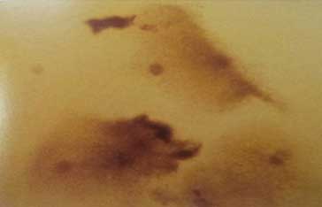 Oocyte Cumulus Complex Oocyte Cumulus Complex
